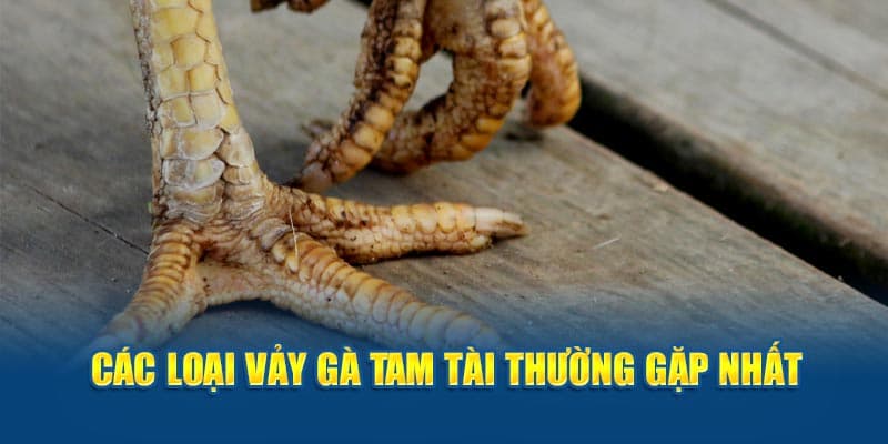 Những biến thể thường gặp nhất của vảy Tam Tài